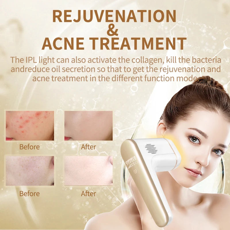 Newest Laser Epilator 3 in 1 IPL Hair Removal for Women Men Razor Acne Treatment Home Bikini Trimmer DropShipping Photoepilator