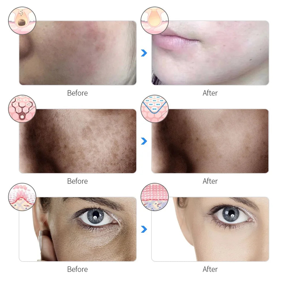 LED Facial Beauty Mask