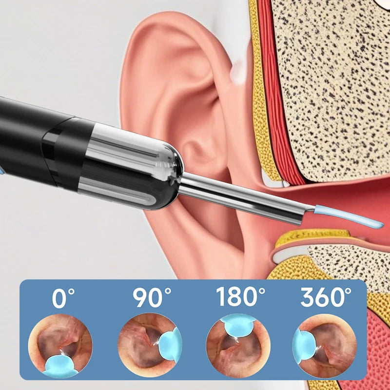 Cámara de limpieza visual de oídos WIFI, removedor de cerumen digital con 6 LED, resistente al agua, 4.2MM HD1080P, estuche con cucharas para oídos