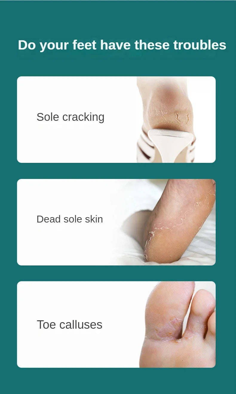 Manikyr Pedikyrverktøy Tåneglbarbermaskin Føtter Pedikyrknivsett Fothårfil Fjerner Død Hud Fotpleieverktøy