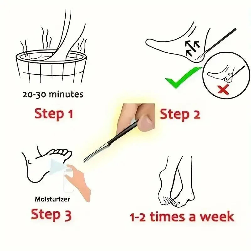 Stainless Steel Dead Skin Remover Toe Nail Shaver Foot Knife And Callus Rasp For Pedicure And Foot Care Skin Care Beauty Tool 1P