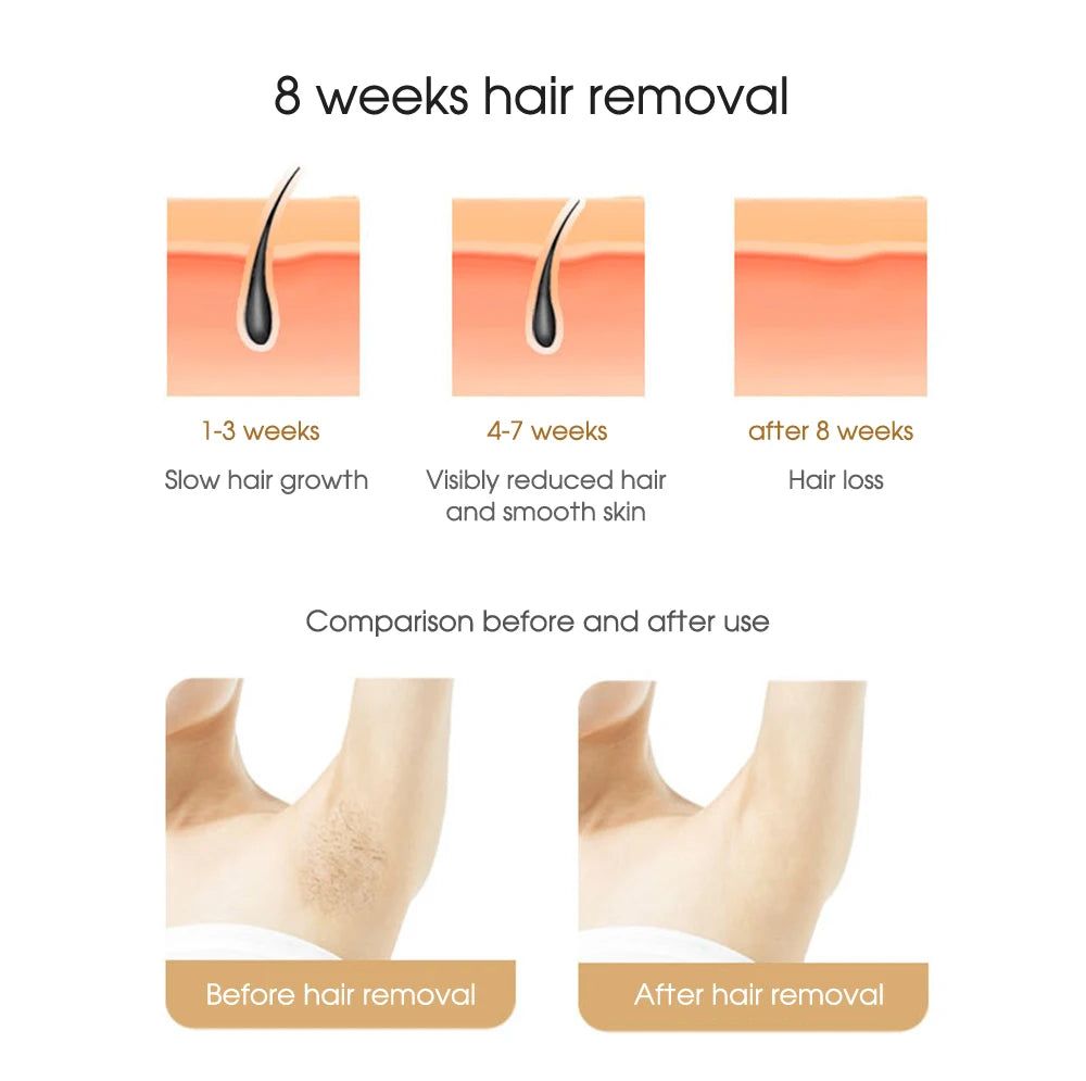 Depiladora Láser IPL Corporal para Bikini, Depilación Láser para Mujeres, Depiladora de Luz Pulsada Permanente, Depiladora Láser de Uso Doméstico