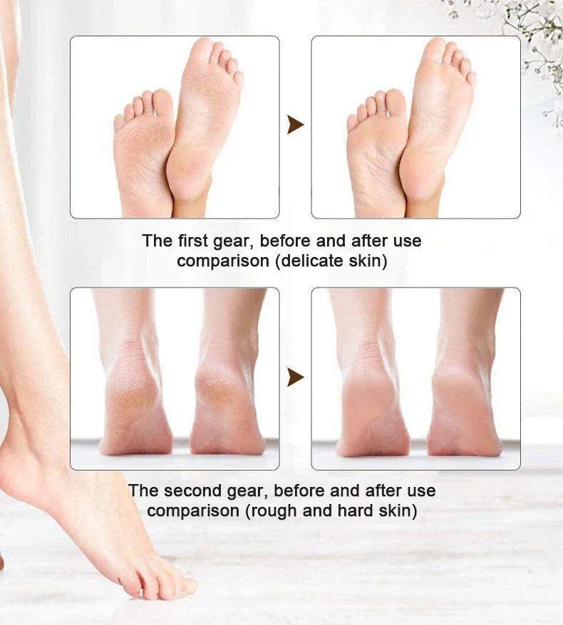 Herramientas de pedicura de molienda eléctrica, lima de papel de lija para pies, herramienta profesional para el cuidado de los pies, herramienta para eliminar callosidades de piel muerta y dura