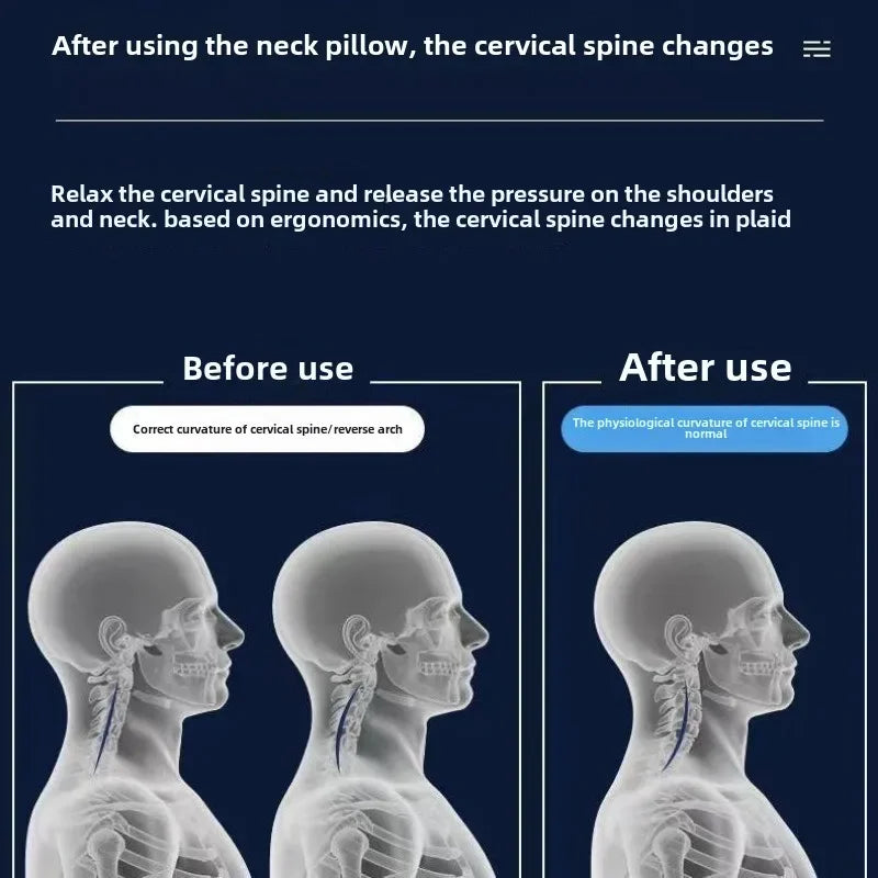 Cervical Pillow Protects Cervical Slow Resilience Memory Cotton Correction Humpback Rich Bag Special Non Collapse Pillow Core