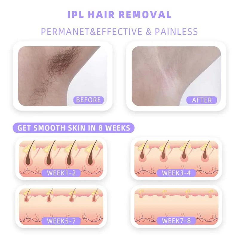 Ipl Laser Hair Removal Flash Depilator Pulses Permanent Laser Epilator Painless For Women Hair Removal Home Use Devices